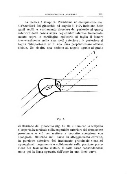 Archivio di ortopedia pubblicazione ufficiale del Pio istituto dei rachitici <1924-1950>