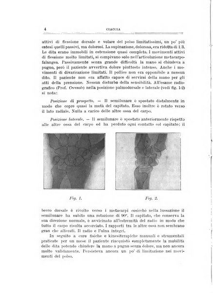 Archivio di ortopedia pubblicazione ufficiale del Pio istituto dei rachitici <1924-1950>