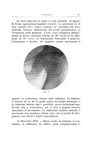 Archivio di ortopedia pubblicazione ufficiale del Pio istituto dei rachitici <1924-1950>