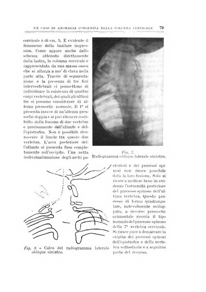 Archivio di ortopedia pubblicazione ufficiale del Pio istituto dei rachitici <1924-1950>