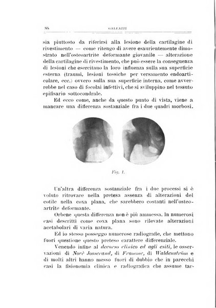 Archivio di ortopedia pubblicazione ufficiale del Pio istituto dei rachitici <1924-1950>