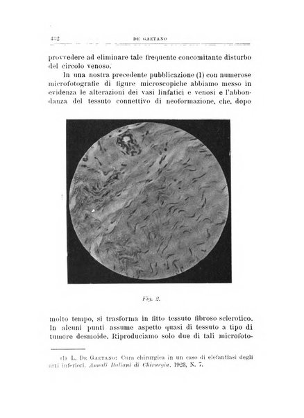 Archivio di ortopedia pubblicazione ufficiale del Pio istituto dei rachitici <1924-1950>