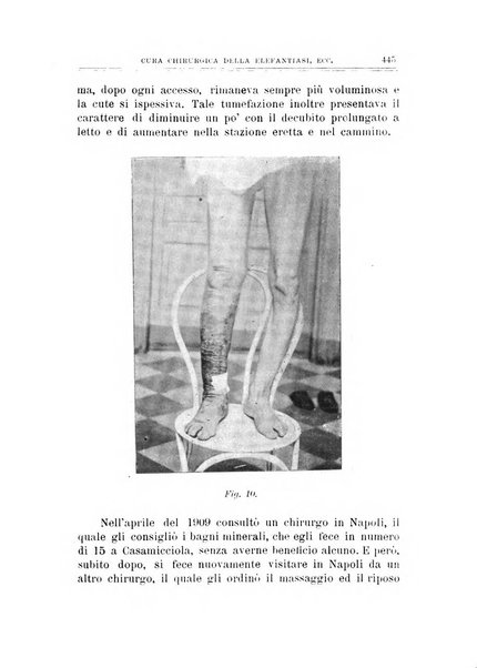 Archivio di ortopedia pubblicazione ufficiale del Pio istituto dei rachitici <1924-1950>