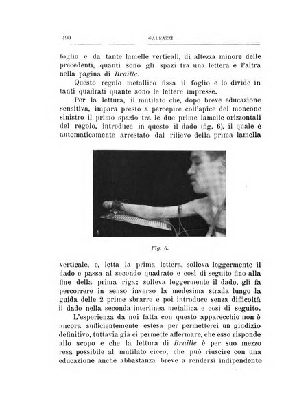 Archivio di ortopedia pubblicazione ufficiale del Pio istituto dei rachitici <1924-1950>