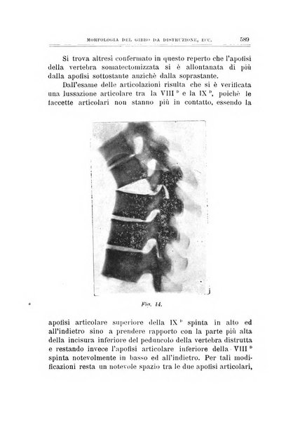 Archivio di ortopedia pubblicazione ufficiale del Pio istituto dei rachitici <1924-1950>