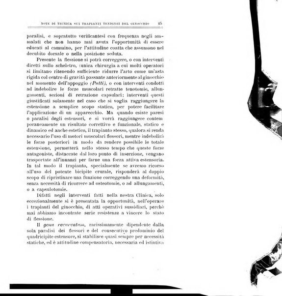 Archivio di ortopedia pubblicazione ufficiale del Pio istituto dei rachitici <1924-1950>