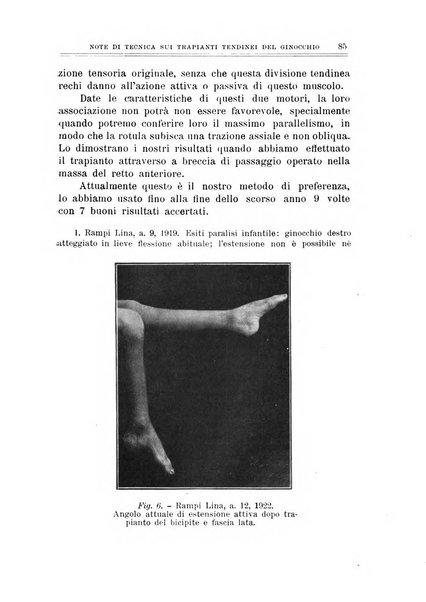 Archivio di ortopedia pubblicazione ufficiale del Pio istituto dei rachitici <1924-1950>