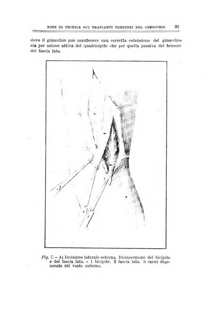 Archivio di ortopedia pubblicazione ufficiale del Pio istituto dei rachitici <1924-1950>