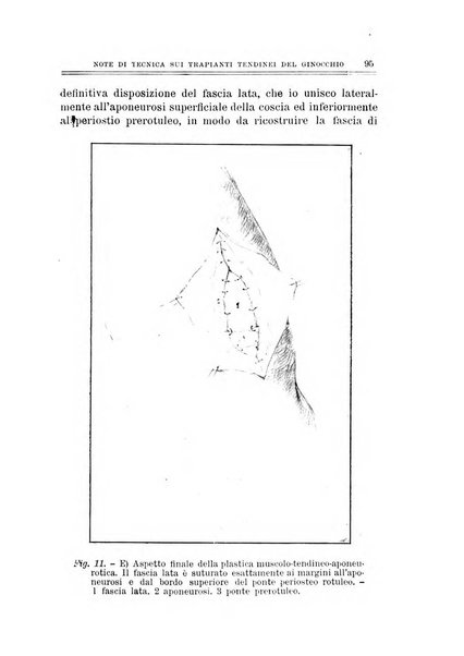 Archivio di ortopedia pubblicazione ufficiale del Pio istituto dei rachitici <1924-1950>