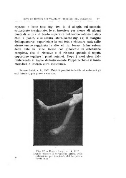 Archivio di ortopedia pubblicazione ufficiale del Pio istituto dei rachitici <1924-1950>