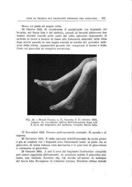 Archivio di ortopedia pubblicazione ufficiale del Pio istituto dei rachitici <1924-1950>