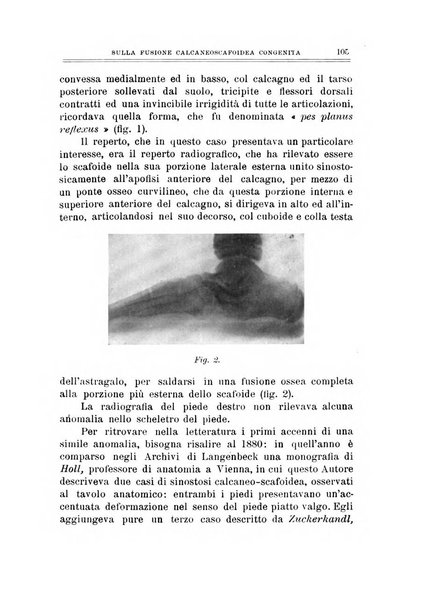 Archivio di ortopedia pubblicazione ufficiale del Pio istituto dei rachitici <1924-1950>