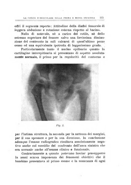 Archivio di ortopedia pubblicazione ufficiale del Pio istituto dei rachitici <1924-1950>