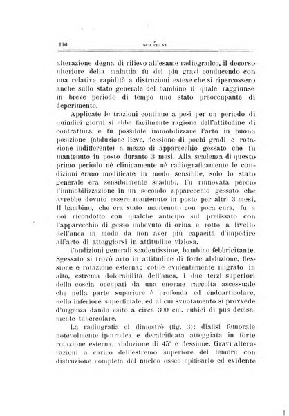 Archivio di ortopedia pubblicazione ufficiale del Pio istituto dei rachitici <1924-1950>