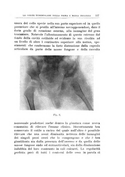 Archivio di ortopedia pubblicazione ufficiale del Pio istituto dei rachitici <1924-1950>