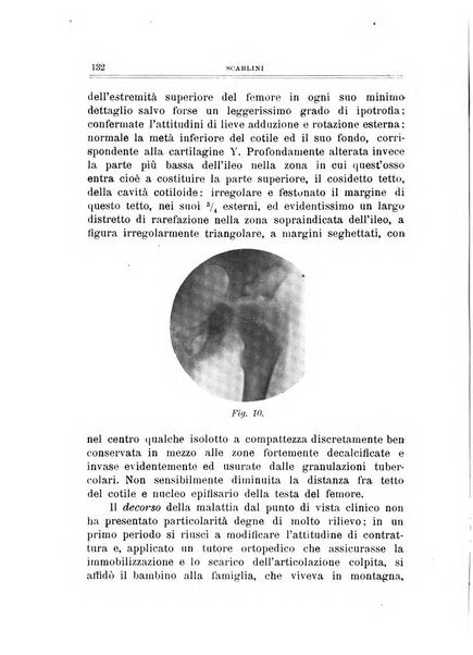 Archivio di ortopedia pubblicazione ufficiale del Pio istituto dei rachitici <1924-1950>