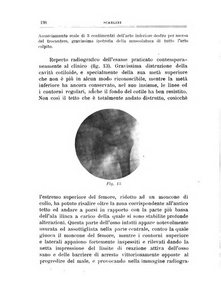 Archivio di ortopedia pubblicazione ufficiale del Pio istituto dei rachitici <1924-1950>