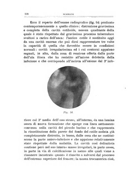 Archivio di ortopedia pubblicazione ufficiale del Pio istituto dei rachitici <1924-1950>