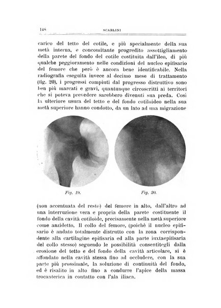 Archivio di ortopedia pubblicazione ufficiale del Pio istituto dei rachitici <1924-1950>