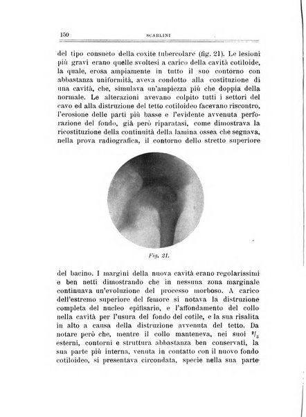 Archivio di ortopedia pubblicazione ufficiale del Pio istituto dei rachitici <1924-1950>