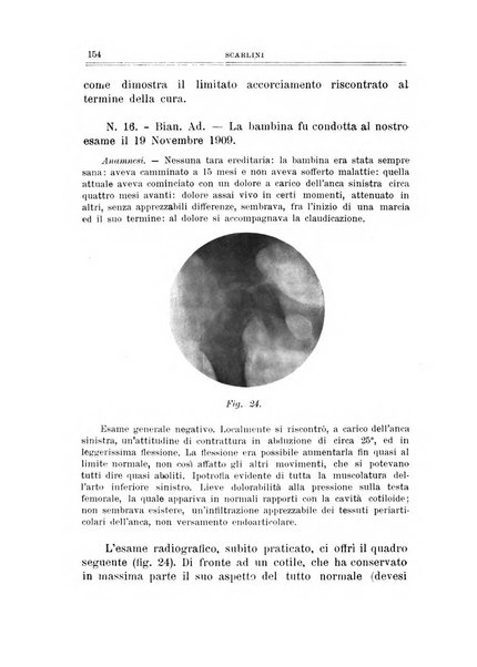 Archivio di ortopedia pubblicazione ufficiale del Pio istituto dei rachitici <1924-1950>