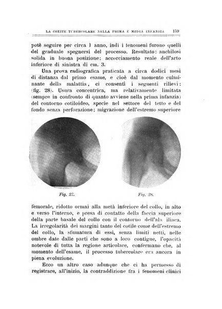 Archivio di ortopedia pubblicazione ufficiale del Pio istituto dei rachitici <1924-1950>