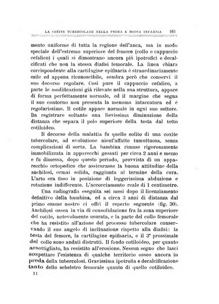 Archivio di ortopedia pubblicazione ufficiale del Pio istituto dei rachitici <1924-1950>