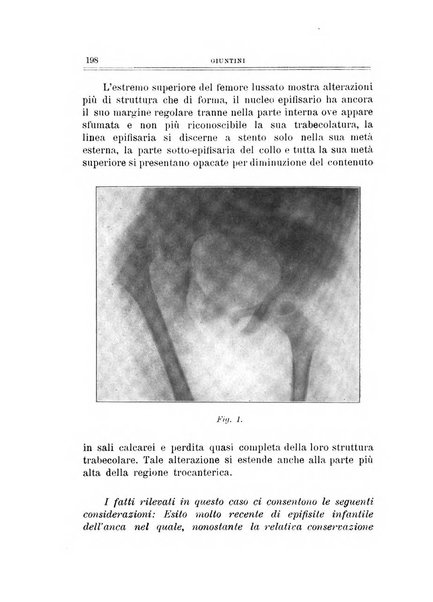 Archivio di ortopedia pubblicazione ufficiale del Pio istituto dei rachitici <1924-1950>