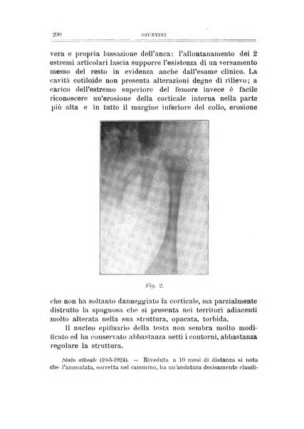 Archivio di ortopedia pubblicazione ufficiale del Pio istituto dei rachitici <1924-1950>