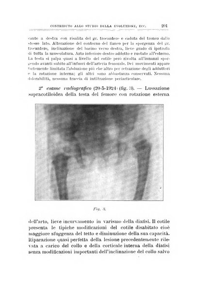 Archivio di ortopedia pubblicazione ufficiale del Pio istituto dei rachitici <1924-1950>