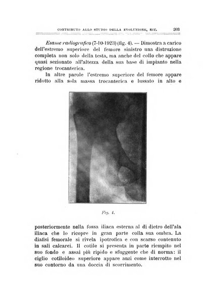 Archivio di ortopedia pubblicazione ufficiale del Pio istituto dei rachitici <1924-1950>