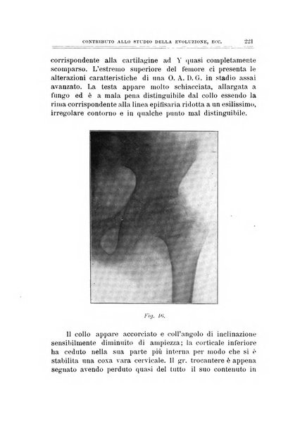 Archivio di ortopedia pubblicazione ufficiale del Pio istituto dei rachitici <1924-1950>