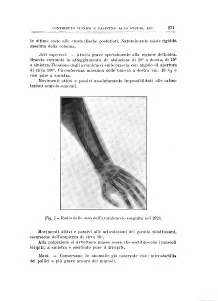 Archivio di ortopedia pubblicazione ufficiale del Pio istituto dei rachitici <1924-1950>