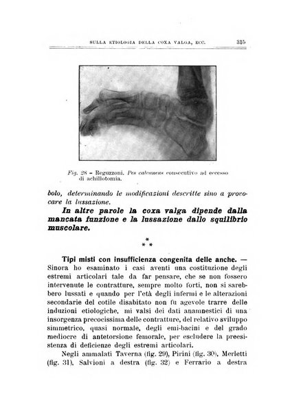 Archivio di ortopedia pubblicazione ufficiale del Pio istituto dei rachitici <1924-1950>