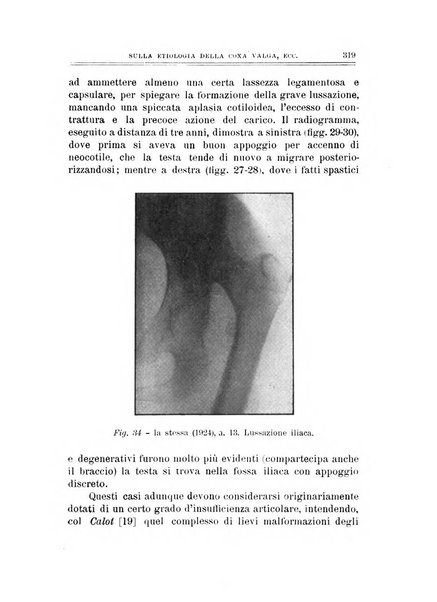 Archivio di ortopedia pubblicazione ufficiale del Pio istituto dei rachitici <1924-1950>