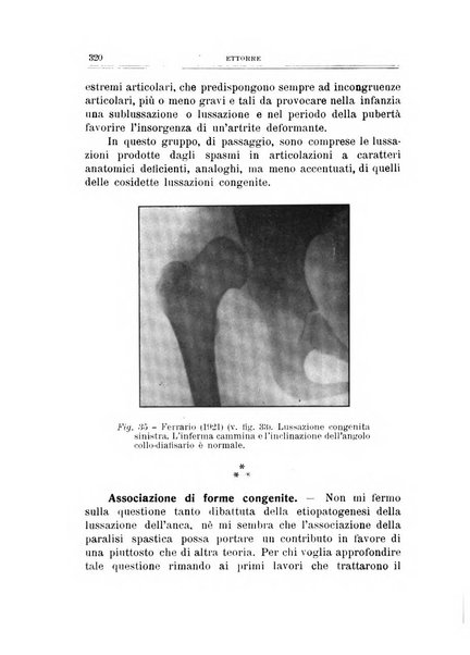 Archivio di ortopedia pubblicazione ufficiale del Pio istituto dei rachitici <1924-1950>