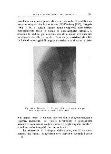 Archivio di ortopedia pubblicazione ufficiale del Pio istituto dei rachitici <1924-1950>