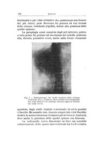 Archivio di ortopedia pubblicazione ufficiale del Pio istituto dei rachitici <1924-1950>