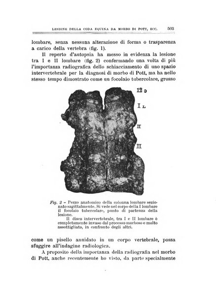 Archivio di ortopedia pubblicazione ufficiale del Pio istituto dei rachitici <1924-1950>