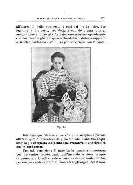 Archivio di ortopedia pubblicazione ufficiale del Pio istituto dei rachitici <1924-1950>