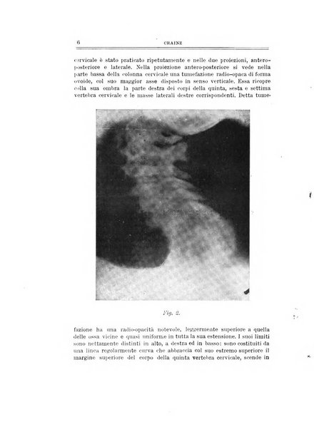 Archivio di ortopedia pubblicazione ufficiale del Pio istituto dei rachitici <1924-1950>