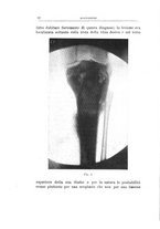 giornale/TO00176849/1925/unico/00000028