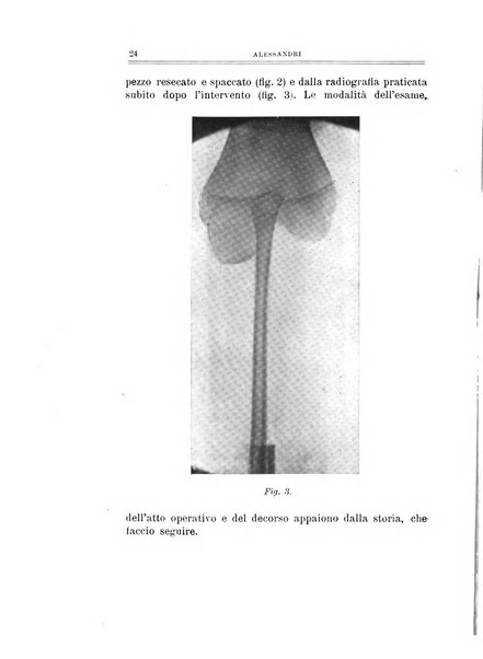 Archivio di ortopedia pubblicazione ufficiale del Pio istituto dei rachitici <1924-1950>