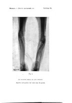 giornale/TO00176849/1925/unico/00000069