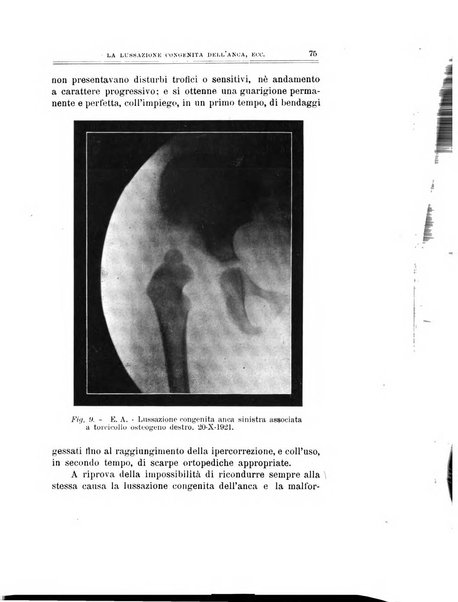 Archivio di ortopedia pubblicazione ufficiale del Pio istituto dei rachitici <1924-1950>