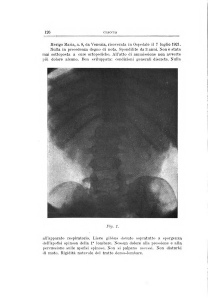 Archivio di ortopedia pubblicazione ufficiale del Pio istituto dei rachitici <1924-1950>