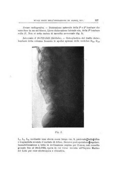 Archivio di ortopedia pubblicazione ufficiale del Pio istituto dei rachitici <1924-1950>