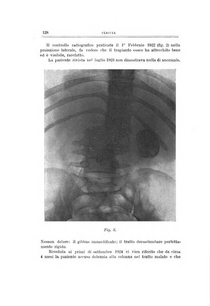 Archivio di ortopedia pubblicazione ufficiale del Pio istituto dei rachitici <1924-1950>