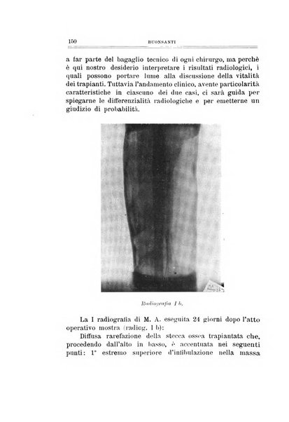 Archivio di ortopedia pubblicazione ufficiale del Pio istituto dei rachitici <1924-1950>