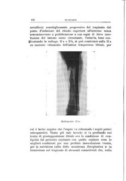 Archivio di ortopedia pubblicazione ufficiale del Pio istituto dei rachitici <1924-1950>